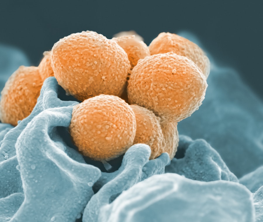 Photo Infection Control